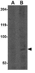 WB analysis of A549 cell lysate using GTX85379 CNOT4 antibody. Working concentration : (A) 1 and (B) 2 microg/ml WB analysis of A549 cell lysate using GTX85379 CNOT4 antibody. Working concentration : (A) 1 and (B) 2 microg/ml