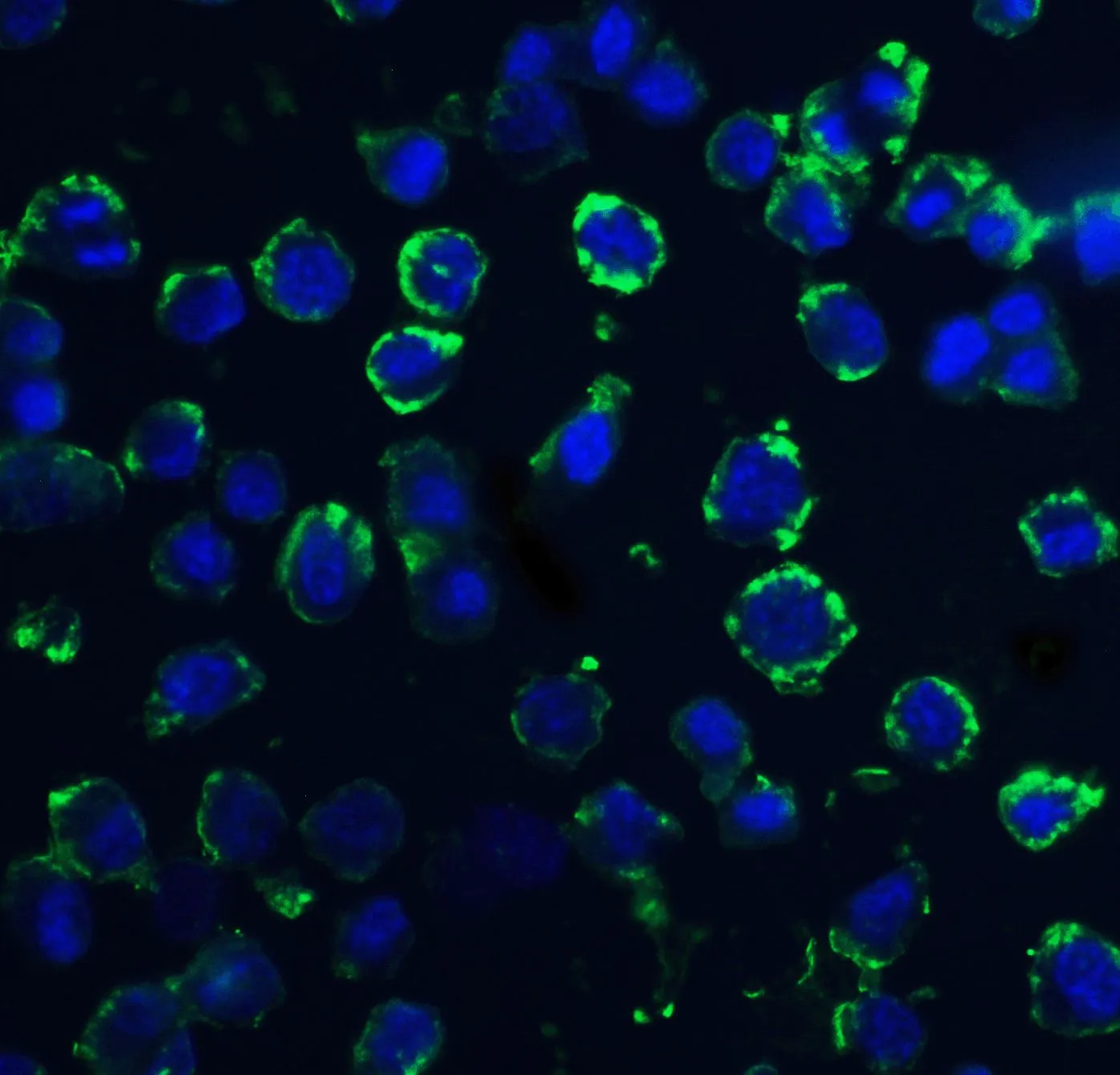 ICC/IF analysis of 3T3 cells using GTX85387 DNAL1 antibody. Green : Primary antibody Blue : DAPI Dilution : 20 microg/ml ICC/IF analysis of 3T3 cells using GTX85387 DNAL1 antibody. Green : Primary antibody Blue : DAPI Dilution : 20 microg/ml