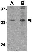 WB analysis of 3T3 cell lysate using GTX85387 DNAL1 antibody. Working concentration : (A) 1 and (B) 2 microg/ml
