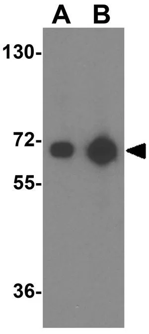 WB analysis of human brain tissue lysate using GTX85398 VGF antibody. Working concentration : (A) 1 and (B) 2 microg/ml