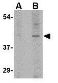 WB analysis of Daudi cell lysate using GTX85399 Slc35D1 antibody. Working concentration : (A) 1 and (B) 2 microg/ml WB analysis of Daudi cell lysate using GTX85399 Slc35D1 antibody. Working concentration : (A) 1 and (B) 2 microg/ml