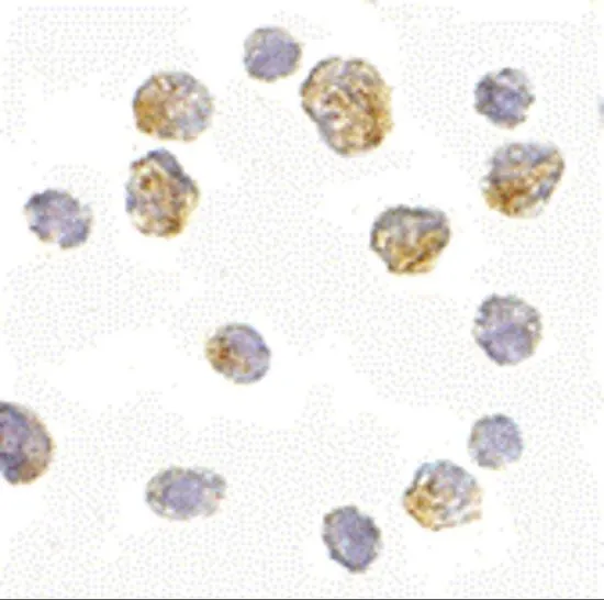 ICC/IF analysis of Daudi cells using GTX85399 Slc35D1 antibody. Working concentration : 5 microg/ml