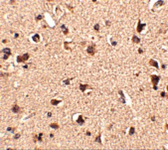 IHC-P analysis of human brain tissue using GTX85411 SLITRK6 antibody. Working concentration : 2.5 microg/ml IHC-P analysis of human brain tissue using GTX85411 SLITRK6 antibody. Working concentration : 2.5 microg/ml
