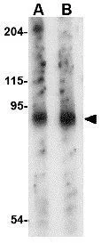 WB analysis of mouse lung tissue lysate using GTX85411 SLITRK6 antibody. Working concentration : (A) 0.5 and (B) 1 microg/ml
