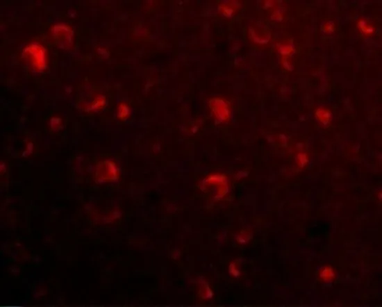 IHC-P analysis of human brain tissue using GTX85411 SLITRK6 antibody. Working concentration : 20 microg/ml