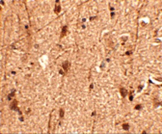 IHC-P analysis of human brain tissue using GTX85417 Slitrk3 antibody. Working concentration : 2.5 microg/ml IHC-P analysis of human brain tissue using GTX85417 Slitrk3 antibody. Working concentration : 2.5 microg/ml