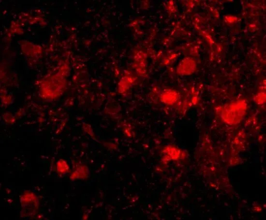 IHC-P analysis of human brain tissue using GTX85417 Slitrk3 antibody. Working concentration : 20 microg/ml