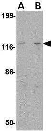 WB analysis of SK-N-SH cell lysate using GTX85417 Slitrk3 antibody. Working concentration : (A) 0.25 and (B) 0.5 microg/ml