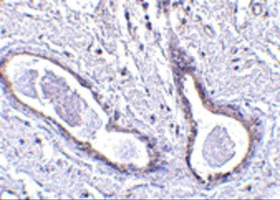 IHC-P analysis of human breast tissue using GTX85433 CCDC98 antibody. Working concentration : 5 microg/ml IHC-P analysis of human breast tissue using GTX85433 CCDC98 antibody. Working concentration : 5 microg/ml