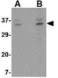 WB analysis of A-20 cell lysate using GTX85438 ORAI3 antibody. Working concentration : (A) 2 and (B) 4 microg/ml WB analysis of A-20 cell lysate using GTX85438 ORAI3 antibody. Working concentration : (A) 2 and (B) 4 microg/ml