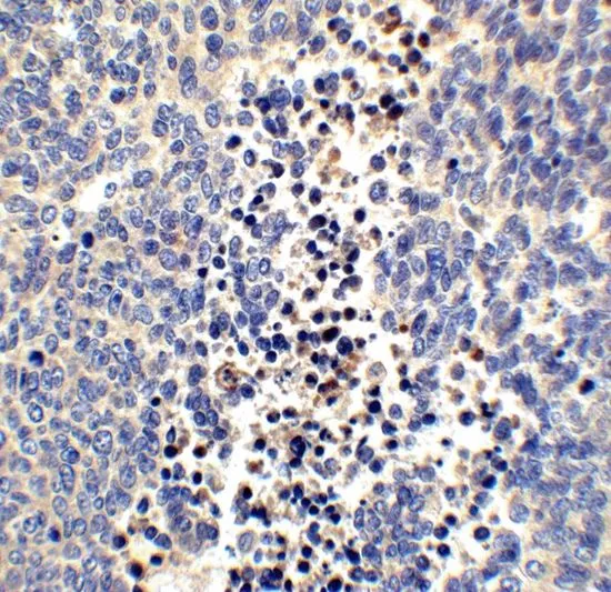 IHC-P analysis of human brain tissue using GTX85446 Neuritin antibody. Working concentration : 2.5 microg/ml