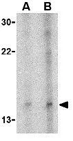 WB analysis of Daudi cell lysate using GTX85446 Neuritin antibody. Working concentration : (A) 5 and (B) 10 microg/ml