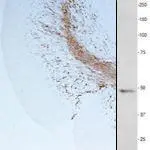 IHC/WB analysis of cerebellar white matter using GTX85451 CNPase antibody. IHC/WB analysis of cerebellar white matter using GTX85451 CNPase antibody.