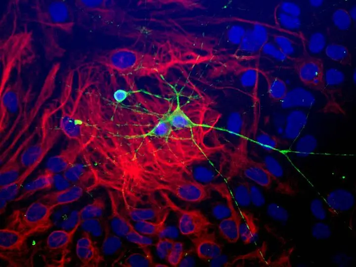 ICC/IF analysis of paraformaldehyde-fixed (4%) neonatal mouse brain cultures using GTX85469 beta Tubulin 3 / Tuj1 antibody. Green : Primary antibody RED : GFAP antibody BLUE : DAPI Dilution : 1:1000
