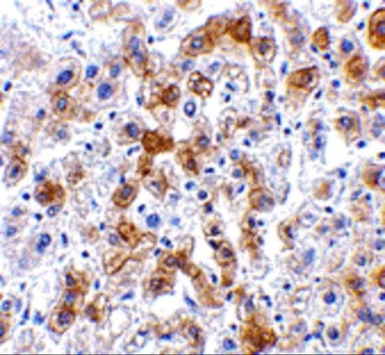 IHC-P analysis of human liver tissue using GTX85482 SCO2 antibody. Working concentration : 2.5 microg/ml IHC-P analysis of human liver tissue using GTX85482 SCO2 antibody. Working concentration : 2.5 microg/ml