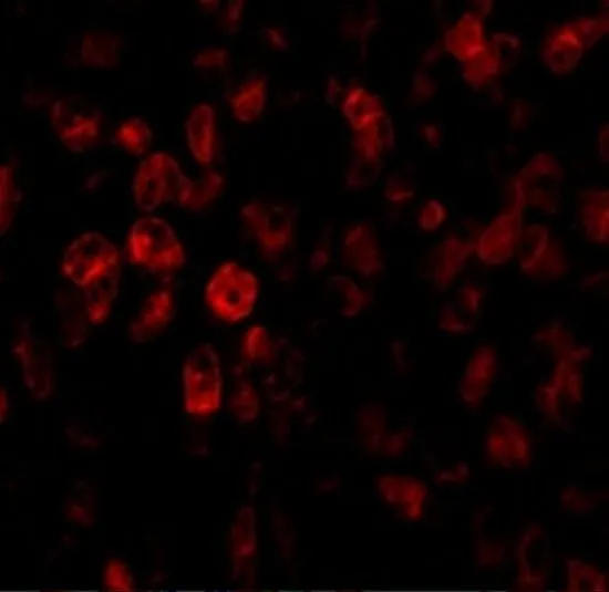 IHC-P analysis of human liver tissue using GTX85482 SCO2 antibody. Working concentration : 20 microg/ml