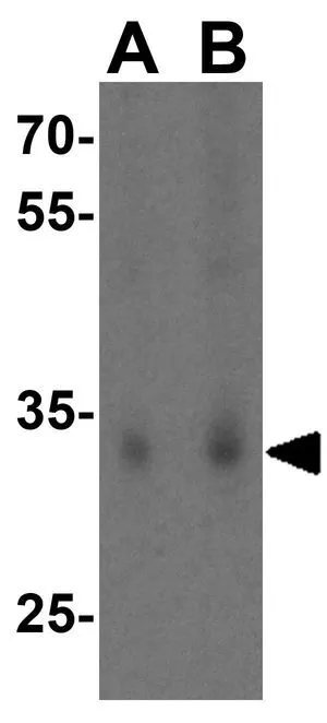 WB analysis of HL-60 cell lysate using GTX85482 SCO2 antibody. Working concentration : (A) 1 and (B) 2 microg/ml