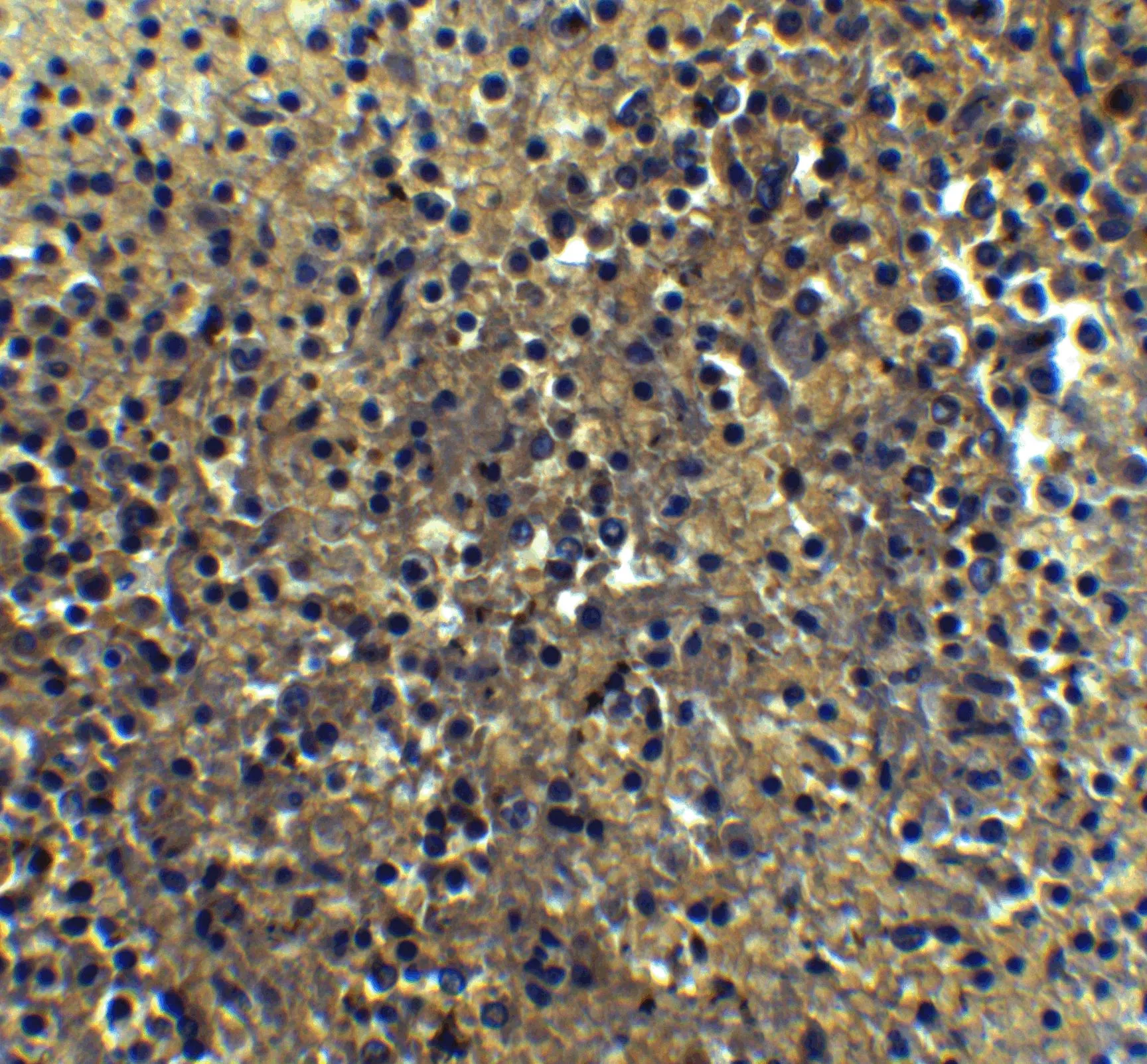 IHC-P analysis of human spleen tissue using GTX85490 IRF7 antibody. Dilution : 5 microg/ml IHC-P analysis of human spleen tissue using GTX85490 IRF7 antibody. Dilution : 5 microg/ml