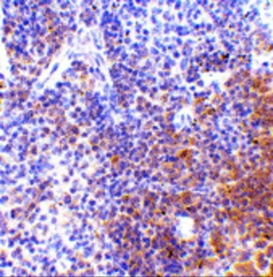 IHC-P analysis of mouse spleen tissue using GTX85490 IRF7 antibody. Working concentration : 5 microg/ml