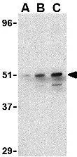 WB analysis of 293 cell lysate using GTX85490 IRF7 antibody. Working concentration : (A) 0.5, (B) 1, and (C) 2 microg/ml