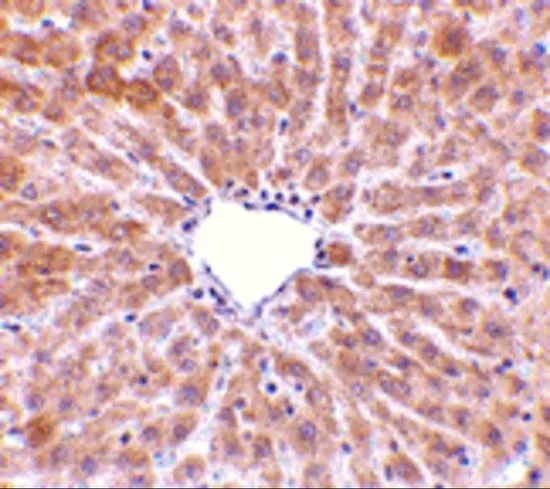 IHC-P analysis of rat liver tissue using GTX85492 TIP47 antibody. Working concentration : 10 microg/ml IHC-P analysis of rat liver tissue using GTX85492 TIP47 antibody. Working concentration : 10 microg/ml