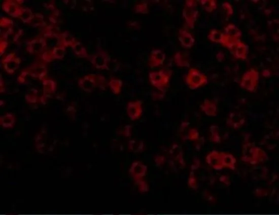 IHC-P analysis of rat liver tissue using GTX85492 TIP47 antibody. Working concentration : 20 microg/ml