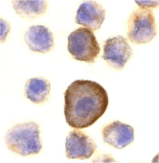 ICC/IF analysis of A431 cells using GTX85520 PERP antibody. Working concentration : 10 ug/ml