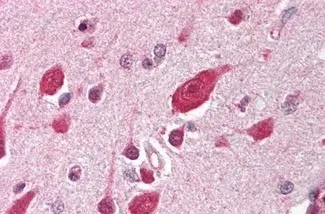 IHC-P analysis of human brain, cortex tissue using GTX85639 DDB1 antibody. Antigen retrieval : Heat-induced antigen retrieval Dilution : 1:500 IHC-P analysis of human brain, cortex tissue using GTX85639 DDB1 antibody. Antigen retrieval : Heat-induced antigen retrieval Dilution : 1:500