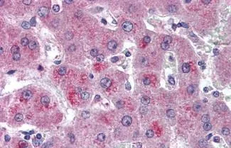 IHC-P analysis of human liver tissue using GTX85675 HTRA3 antibody. Antigen retrieval : Heat-induced antigen retrieval Dilution : 10 microg/ml IHC-P analysis of human liver tissue using GTX85675 HTRA3 antibody. Antigen retrieval : Heat-induced antigen retrieval Dilution : 10 microg/ml