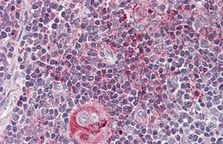 Immunohistochemical staining of human Thymus tissue sections using WNT5B antibody (GTX85688)