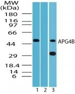 Human Heart (formalin-fixed,paraffin-embedded) stained with ATG4B antibody (GTX85759) at 10 ug/ml followed by biotinylated goat anti-rabbit IgG secondary antibody LS-D1,alkaline phosphatase-streptavidin and chromogen.