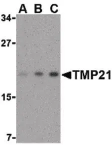 Human Prostate (formalin-fixed,paraffin-embedded) stained with TMED10 antibody (GTX85769) at 5 ug/ml followed by biotinylated goat anti-rabbit IgG secondary antibody LS-D1,alkaline phosphatase-streptavidin and chromogen.