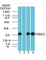 WB analysis of human brain lysate1) absence, 2) presence of immunizing peptide, 3) mouse brain lysate, and 4) in rat brain lysate using GTX85776 FAM3C antibody. Dilution : 0.5 microg/ml WB analysis of human brain lysate1) absence, 2) presence of immunizing peptide, 3) mouse brain lysate, and 4) in rat brain lysate using GTX85776 FAM3C antibody. Dilution : 0.5 microg/ml