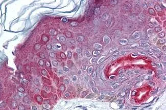 IHC-P analysis of human skin tissue using GTX85776 FAM3C antibody. Antigen retrieval : Heat-induced antigen retrieval Dilution : 10 microg/ml
