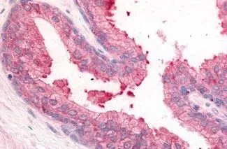 IHC-P analysis of human prostate tissue using GTX85838 PDE8A antibody. Antigen retrieval : Heat-induced antigen retrieval IHC-P analysis of human prostate tissue using GTX85838 PDE8A antibody. Antigen retrieval : Heat-induced antigen retrieval