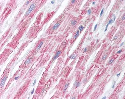 Human Heart (formalin-fixed, paraffin-embedded) stained with KCNC2 antibody (GTX85861) at 10 ug/ml followed by biotinylated goat anti-rabbit IgG secondary antibody LS-D1, alkaline phosphatase-streptavidin and chromogen. Human Heart (formalin-fixed, paraffin-embedded) stained with KCNC2 antibody (GTX85861) at 10 ug/ml followed by biotinylated goat anti-rabbit IgG secondary antibody LS-D1, alkaline phosphatase-streptavidin and chromogen.