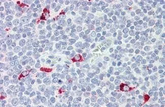 IHC-P analysis of human tonsil tissue using GTX85864 IRF7 antibody [3D9]. Antigen retrieval : Heat-induced antigen retrieval Dilution : 20 microg/ml