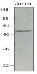 WB analysis of Jurkat (40 ug) cell lysate using GTX85864 IRF7 antibody [3D9]. Dilution : 1:1000