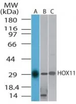 Western blot of HOX11 in A) human,B) mouse and C) ratuliver cell lysate using antibody at 1 ug/ml.