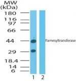Human Prostate (formalin-fixed,paraffin-embedded) stained with FNTA antibody (GTX85881) at 10 ug/ml followed by biotinylated goat anti-rabbit IgG secondary antibody LS-D1,alkaline phosphatase-streptavidin and chromogen.
