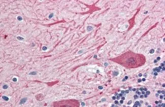 IHC-P analysis of human brain, cerebellum tissue using GTX85883 Syntaxin 2 antibody. Antigen retrieval : Heat-induced antigen retrieval Dilution : 10 microg/ml IHC-P analysis of human brain, cerebellum tissue using GTX85883 Syntaxin 2 antibody. Antigen retrieval : Heat-induced antigen retrieval Dilution : 10 microg/ml