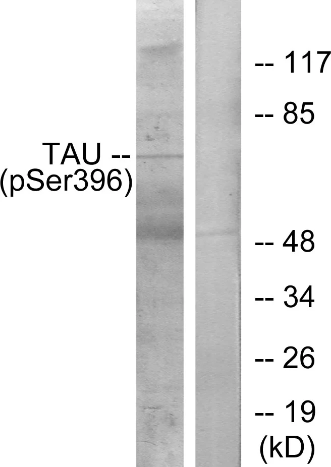WB analysis of HeLa cell lysates using GTX86695 Tau (phospho Ser396) antibody. The lane on the right is blocked with the synthesized peptide. WB analysis of HeLa cell lysates using GTX86695 Tau (phospho Ser396) antibody. The lane on the right is blocked with the synthesized peptide.