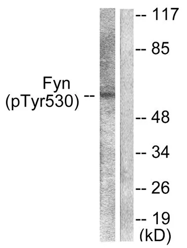 WB analysis of 293 cells treated with H?O? 100uM 15 mins lysates GTX86757 Fyn (phospho Tyr530) antibody. The lane on the right is blocked with the phospho peptide.