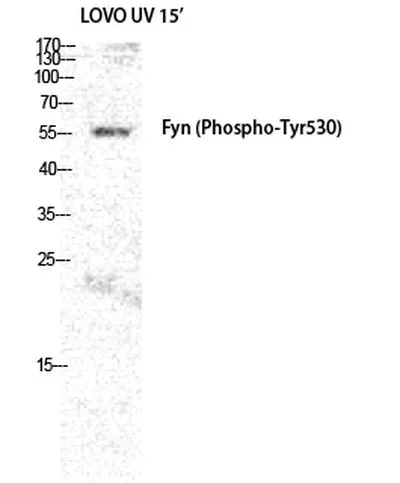 WB analysis of LOVO+UV cell lysates using GTX86757 Fyn (phospho Tyr530) antibody. Dilution : 1:2000