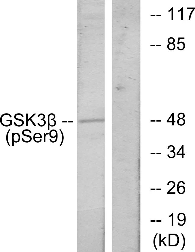 WB analysis of HeLa cells treated with EGF lysate using GTX86837 GSK3 beta (phospho Ser9) antibody. The lane on the right is blocked with the synthesized peptide.