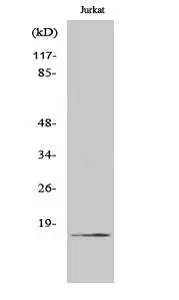 WB analysis of Jurkat cells treated with etoposide using GTX86939 Factor VII (cleaved Arg212) antibody.