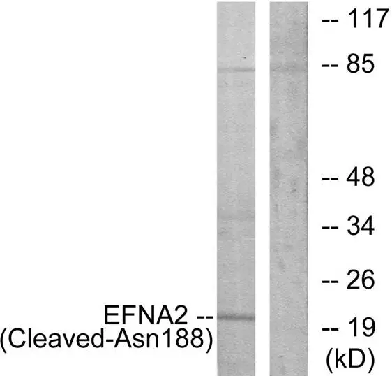 WB analysis of 293 cells treated with etoposide 25uM (1h) lysate using GTX86940 Ephrin A2 (cleaved Asn188) antibody. The lane on the right is blocked with the synthesized peptide. WB analysis of 293 cells treated with etoposide 25uM (1h) lysate using GTX86940 Ephrin A2 (cleaved Asn188) antibody. The lane on the right is blocked with the synthesized peptide.