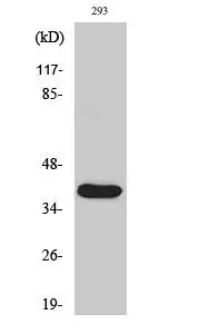 WB analysis of 293 cells treated with etoposide using GTX86949 MMP23 (cleaved Tyr79) antibody. WB analysis of 293 cells treated with etoposide using GTX86949 MMP23 (cleaved Tyr79) antibody.