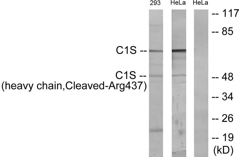 WB analysis of 293 and HeLa cells treated with etoposide 25uM (1h) lysate using GTX86953 C1s (cleaved Arg437) antibody. The lane on the right is blocked with the synthesized peptide. WB analysis of 293 and HeLa cells treated with etoposide 25uM (1h) lysate using GTX86953 C1s (cleaved Arg437) antibody. The lane on the right is blocked with the synthesized peptide.