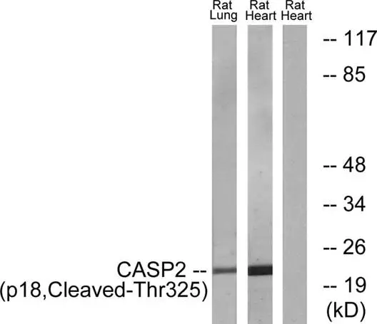 WB analysis of rat heart and lung tissue lysates using GTX86954 Caspase 2 (cleaved Thr325) antibody. The lane on the right is blocked with the synthesized peptide.